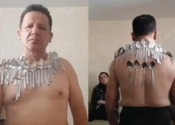 Nuevo récord mundial: hombre logra fijarse 96 cucharas en el cuerpo