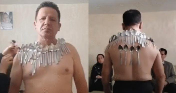 Nuevo récord mundial: hombre logra fijarse 96 cucharas en el cuerpo