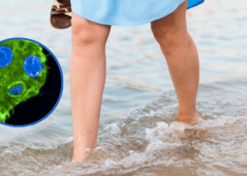 Alertan por bacteria carnívora que está presente en el mar: hay cuatro muertos en la Florida