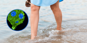Alertan por bacteria carnívora que está presente en el mar: hay cuatro muertos en la Florida