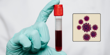 Virus Nipah tiene en alerta al mundo: ¿podría llegar a Colombia?