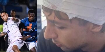Altercado tras el triunfo de Boyacá Chicó ante Millonarios en Tunja deja un jugador lesionado